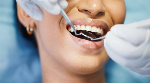 Best Emergency Treatment for Dental Infections or Abscesses in Rockford, MN